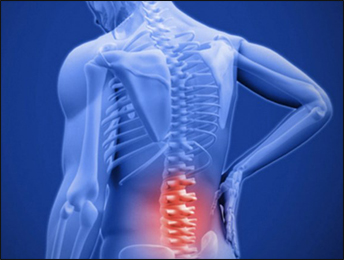 Ankylosing Spondylitis