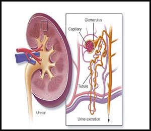 Diet Chart for Nephrotic Syndrome - Foods to Avoid and Consume in ...