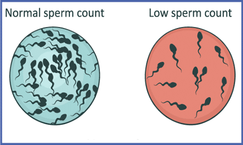 Confirmed: Couch Potatoes Have Lower Sperm Counts