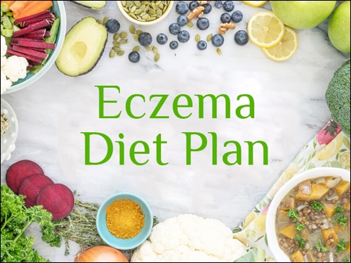 Diet plan for eczema, Diet chart for eczema, Healthy Diet for Eczema Patients