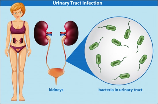 7 Things To Do While Suffering From UTI (Urinary Tract Infection)