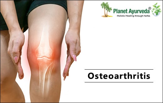 Osteoarthritis, Myth and Facts