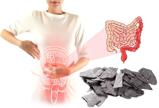 Parpati Kalpana – Therapeutic Use In Ulcerative Colitis