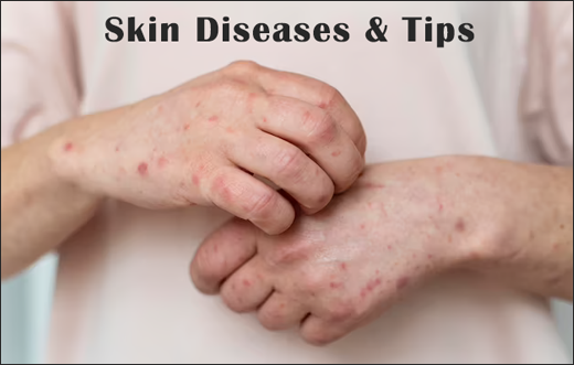 Skin Diseases And Tips