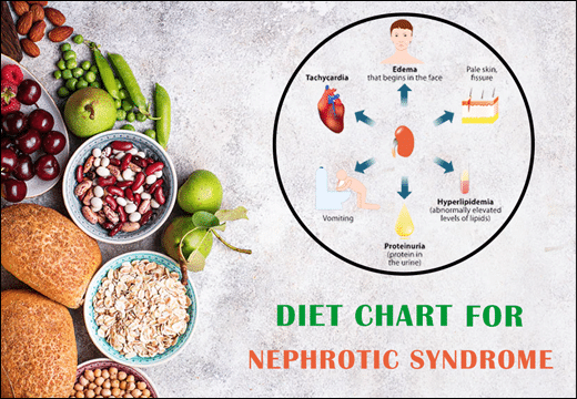 Nephrotic Syndrome, Diet Chart for Nephrotic Syndrome, Diet Plan for Nephrotic Syndrome, Nephrotic Syndrome Diet Chart, Planet Ayurveda Diet Chart, Diet For Nephrotic Syndrome, Nephrotic Syndrome Diet