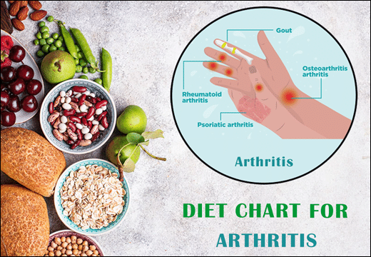 Arthritis, Diet Chart for Arthritis, Diet Plan for Arthritis, Joints Pain, Arthritis Diseases, Arthritis Diet Chart, Arthritis Diet Plan, Planet Ayurveda Diet Chart, Planet Ayurveda Diet Chart For Arthritis