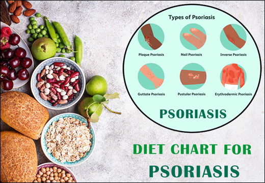 Psoriasis, Diet Chart for Psoriasis, Diet Plan for Psoriasis, Psoriasis Diet Chart, Psoriasis Diet Plan, Planet Ayurveda Diet Chart, Planet Ayurveda Diet Chart For Psoriasis