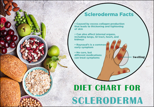 Scleroderma