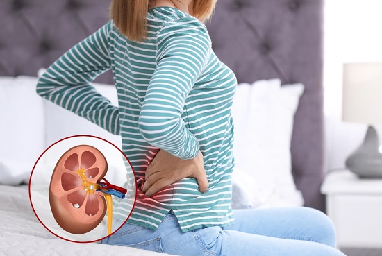 Ayurvedic Treatment of Kidney Stones