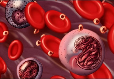 Treat Chronic Myelomonocytic Leukemia (CMML)