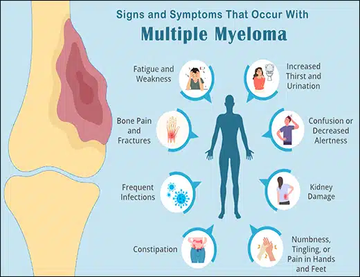 All About Multiple Myeloma and its Ayurvedic Treatment; Kirron Kher also Struggled with it