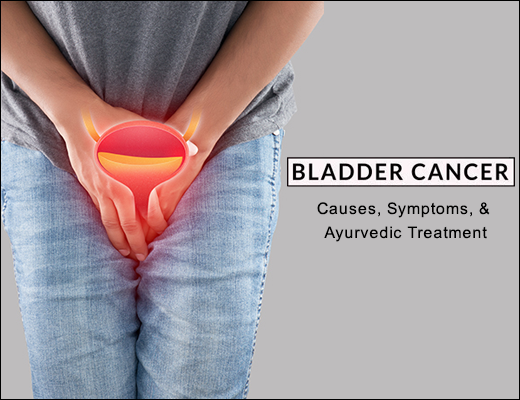 Bladder Cancer, Symptoms, Causes, Management, Ayurvedic Treatment, Herbal Remeides, Bladder Cancer with Herbal Remedies, Ayurvedic treatment for Bladder Cancer, Bladder Cancer Causes, Bladder Cancer Symptoms, What is Bladder Cancer