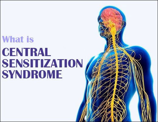 Central Sensitization Syndrome