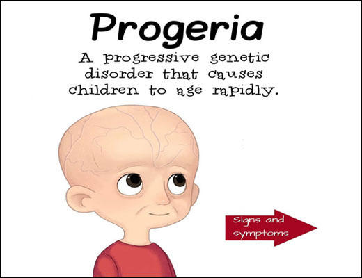 Ayurvedic Treatment For Progeria with Herbal Remedies