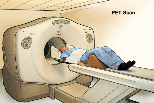 What is a PET Scan and How does it work?